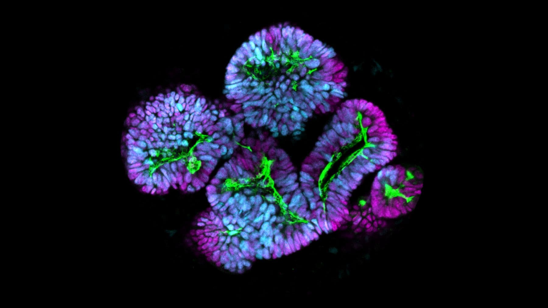 Organoides renales cultivados en laboratorio por científicos para crear riñones artificiales.