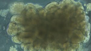 Un mini cerebro artificial se enfrenta al péndulo invertido, y lo sorprendente no es el fracaso, sino lo que revela sobre la toma de decisiones y el control, un experimento que pone nerviosos a los ingenieros